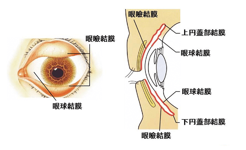 結膜炎 症状